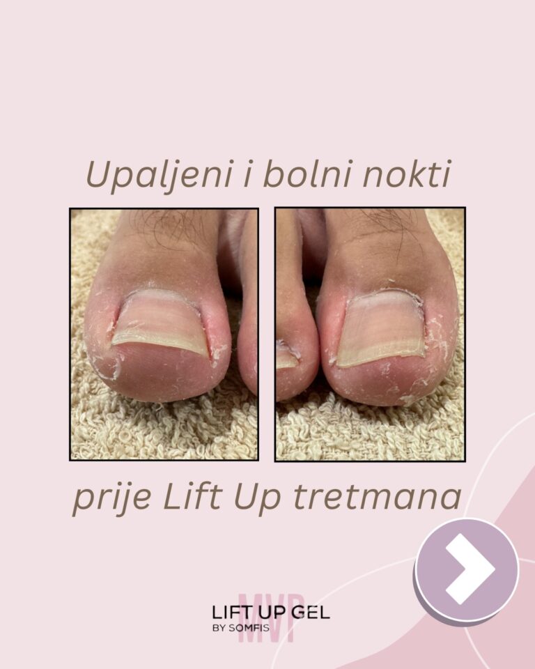 Instagram post from liftup_bosna_i_hercegovina. This post is in position 1.