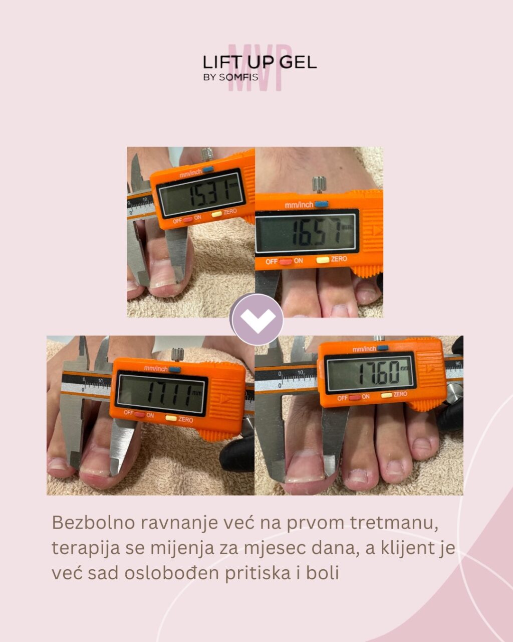 Instagram post from liftup_bosna_i_hercegovina. This post is in position 1.