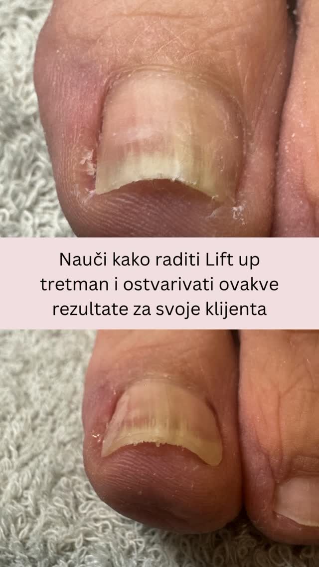 Instagram post from liftup_bosna_i_hercegovina. This post is in position 2.