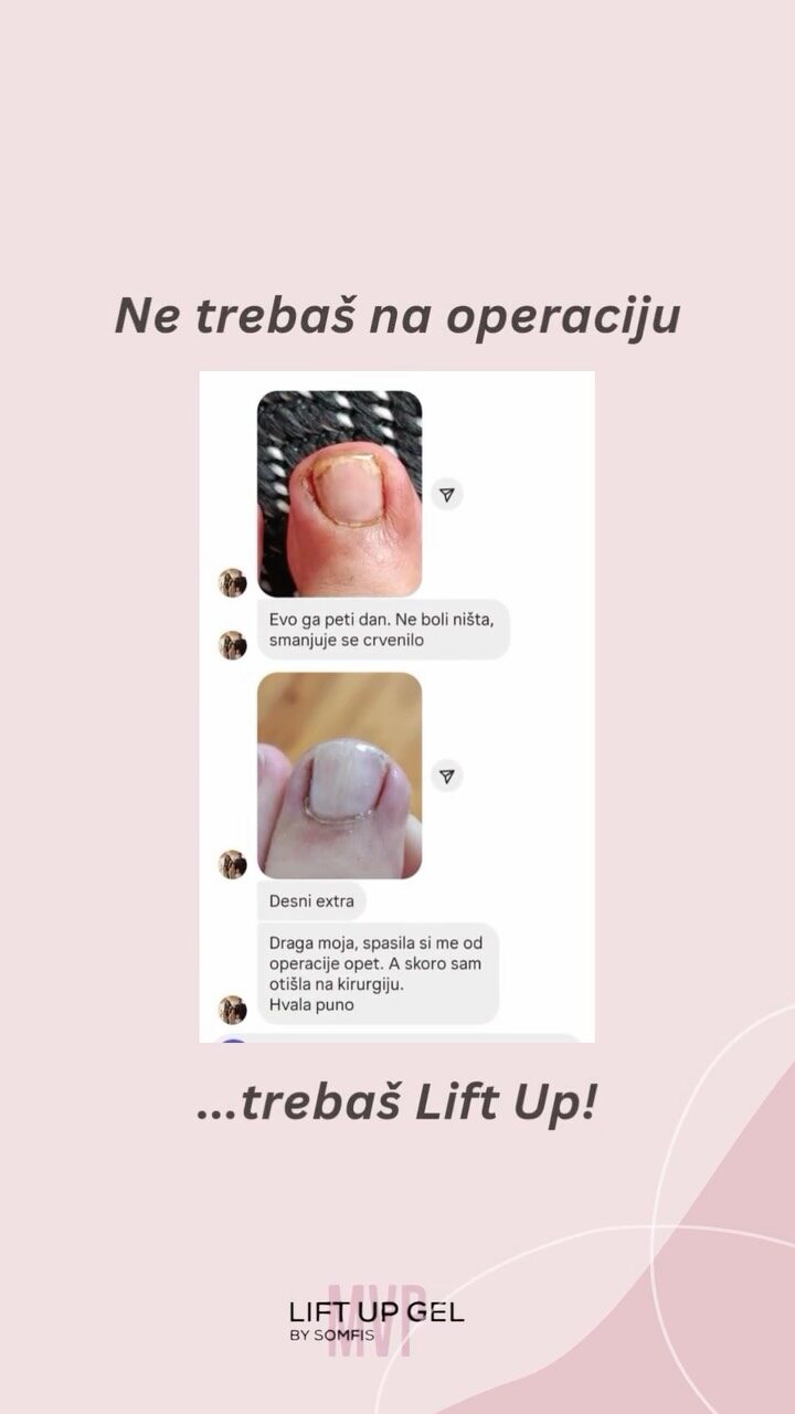 Instagram post from liftup_bosna_i_hercegovina. This post is in position 4.